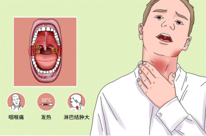 喉咙痛别忽视小心扁桃体炎